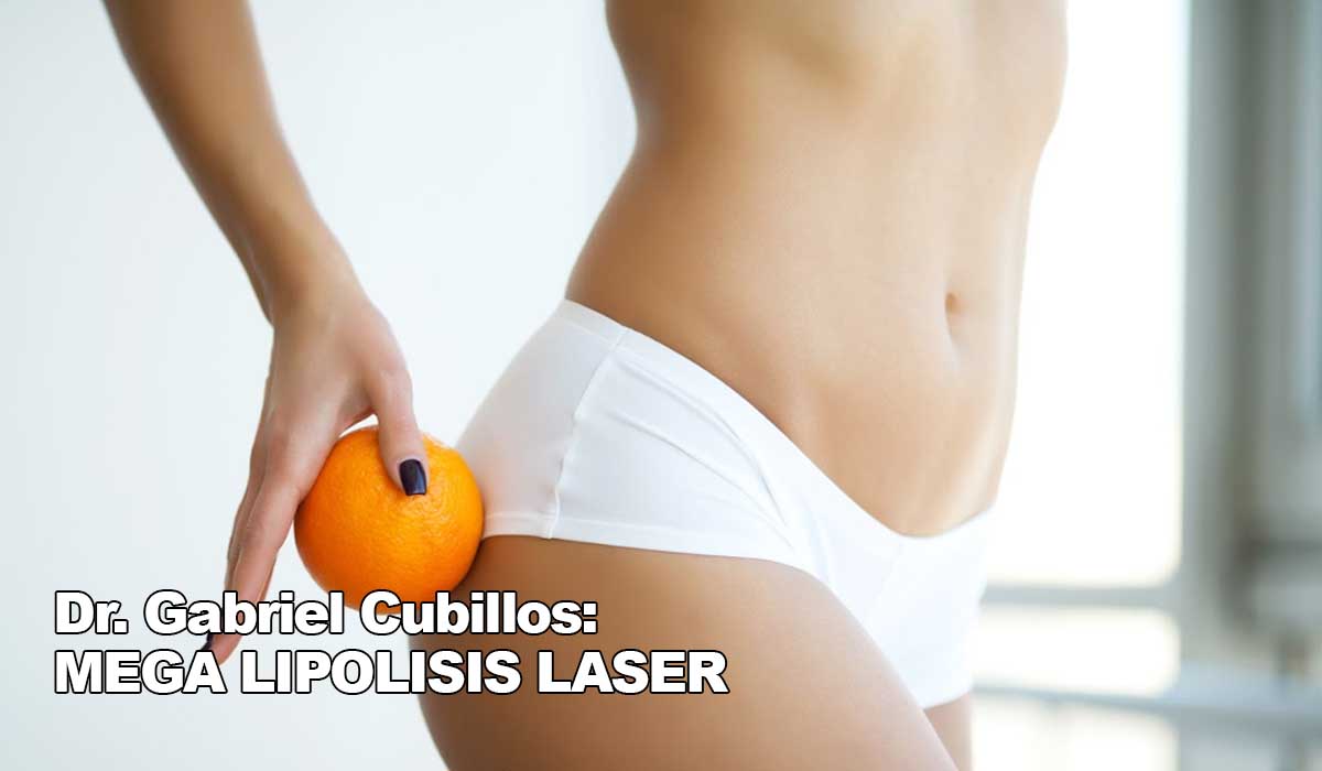 Dr Gabriel Cubillos mega lipolisis laser pexia glutea levantamiento mamario
